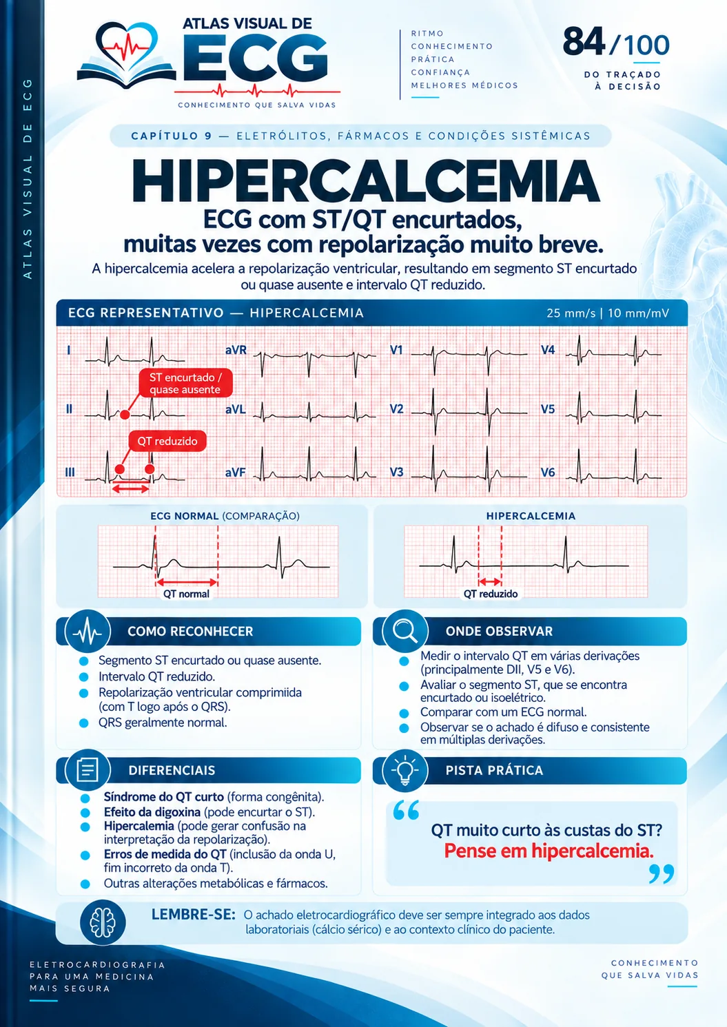 ECG 084