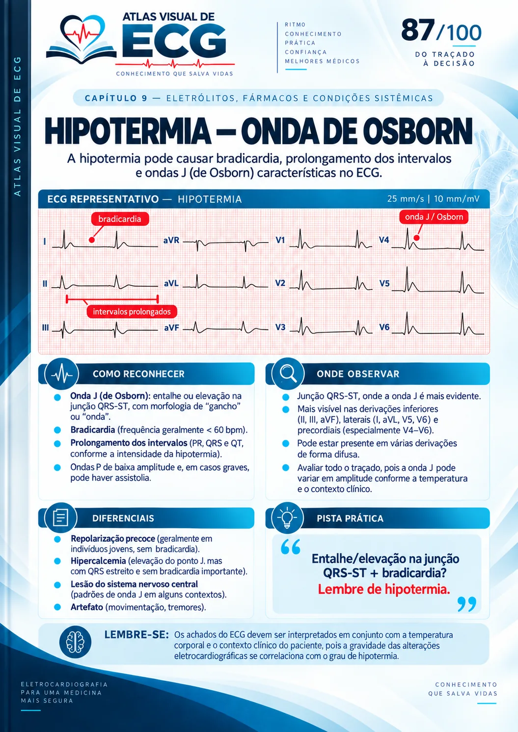 ECG 087
