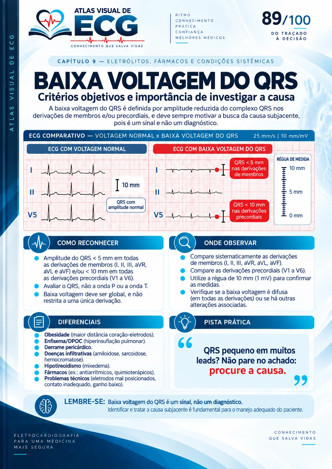 ECG 089