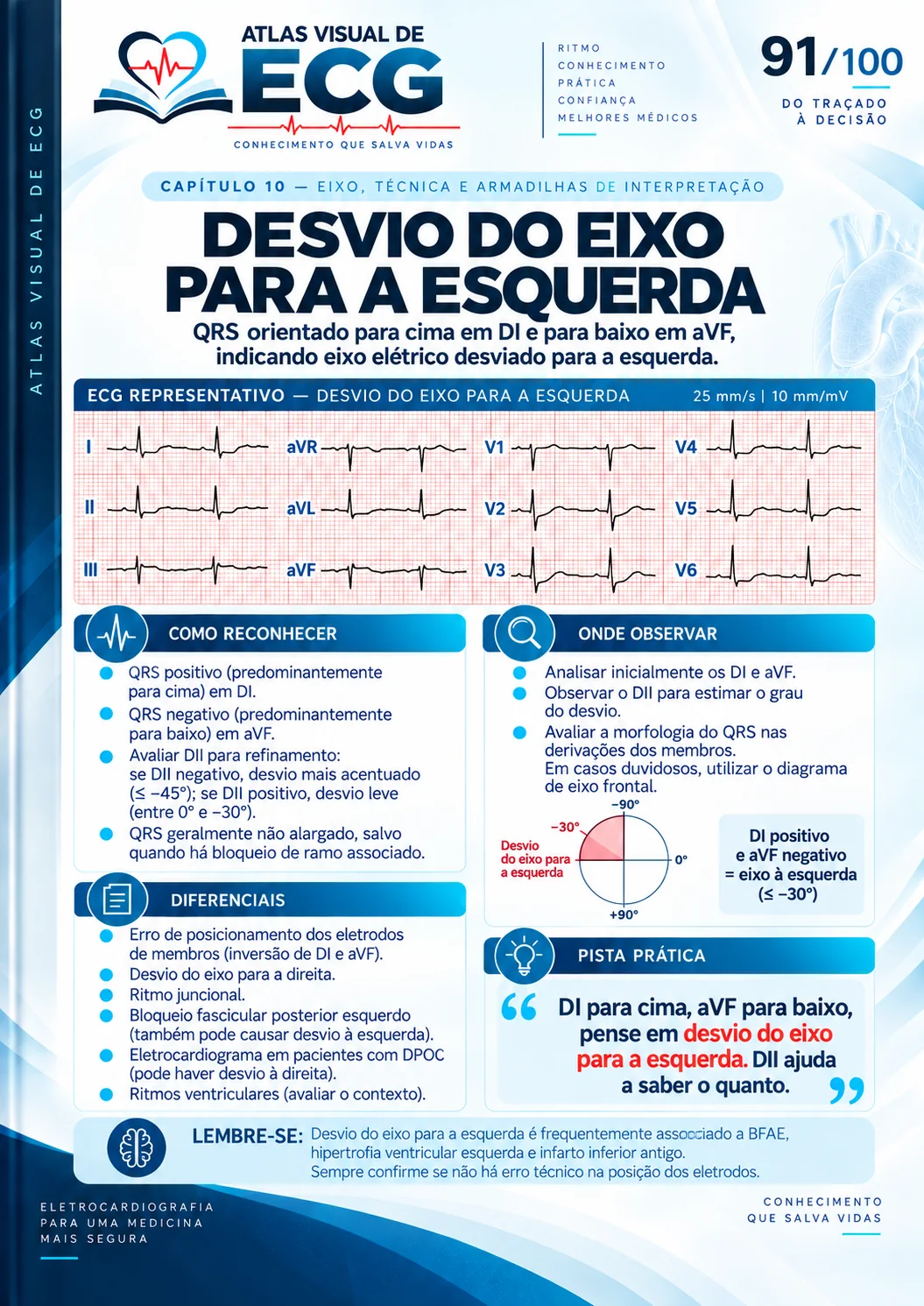 ECG 091