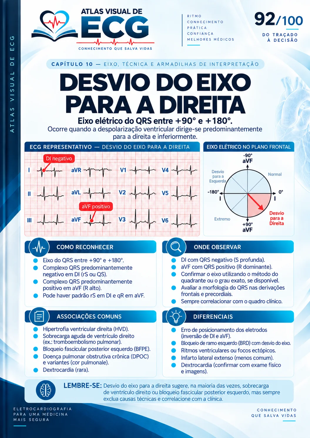 ECG 092